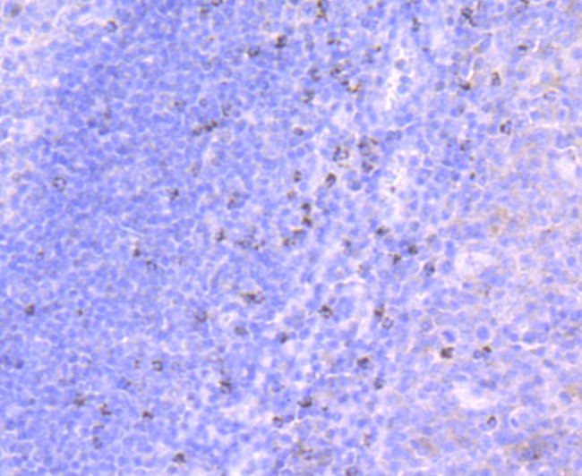 TIA-1 Antibody in Immunohistochemistry (Paraffin) (IHC (P))