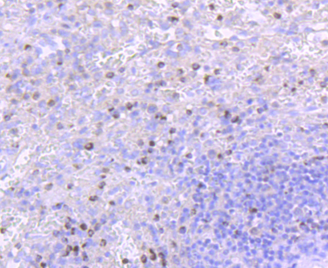 TIA-1 Antibody in Immunohistochemistry (Paraffin) (IHC (P))