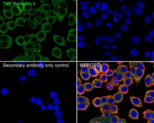 TNFR2 Antibody in Immunocytochemistry (ICC/IF)