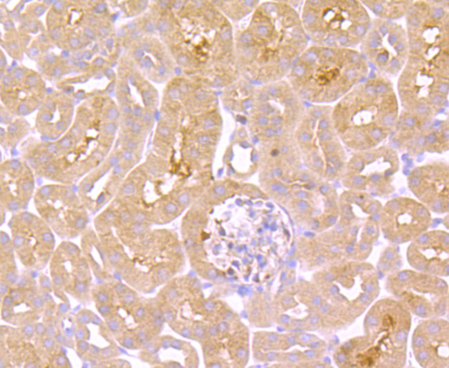 TNFR2 Antibody in Immunohistochemistry (Paraffin) (IHC (P))