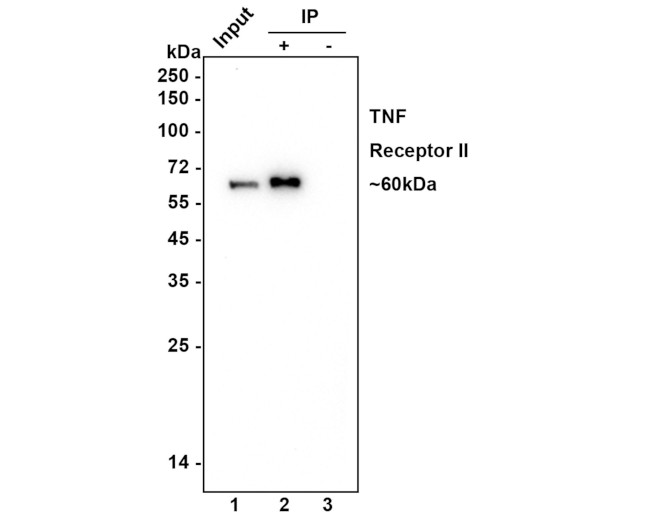 TNFR2 Antibody in Immunoprecipitation (IP)