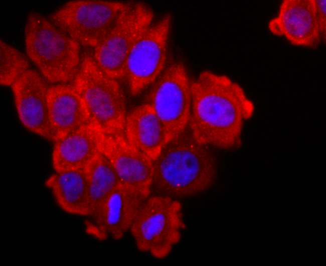 FGFR3 Antibody in Immunocytochemistry (ICC/IF)