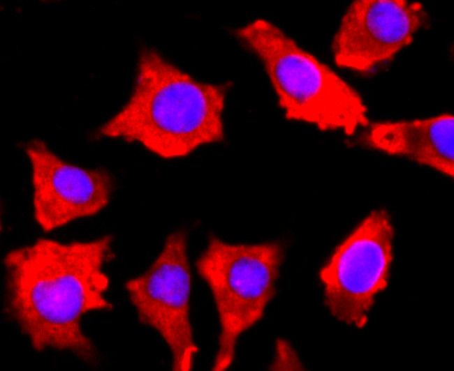 FGFR3 Antibody in Immunocytochemistry (ICC/IF)