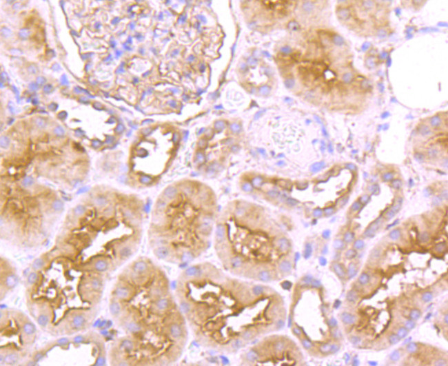 FGFR3 Antibody in Immunohistochemistry (Paraffin) (IHC (P))