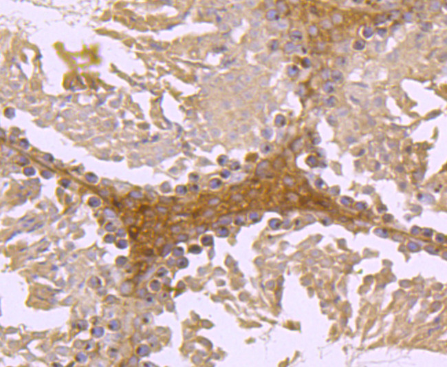 FGFR3 Antibody in Immunohistochemistry (Paraffin) (IHC (P))