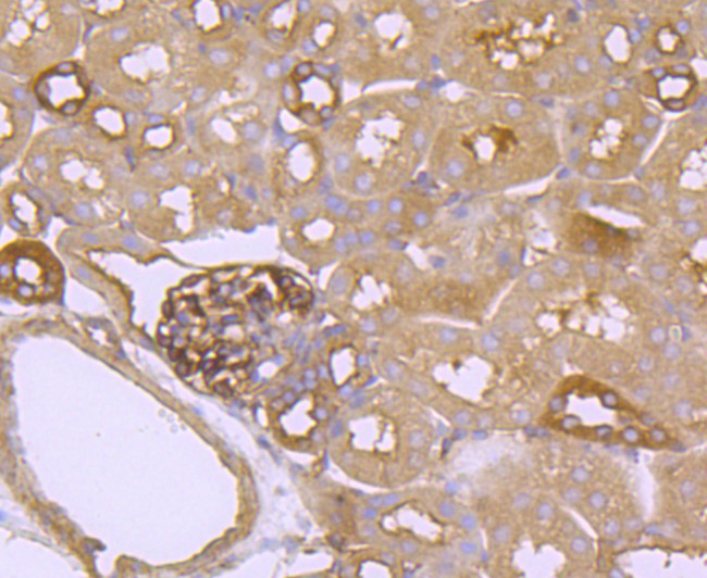 FGFR3 Antibody in Immunohistochemistry (Paraffin) (IHC (P))