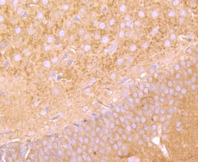 FGFR3 Antibody in Immunohistochemistry (Paraffin) (IHC (P))