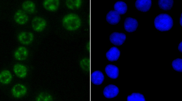 PABPN1 Antibody in Immunocytochemistry (ICC/IF)