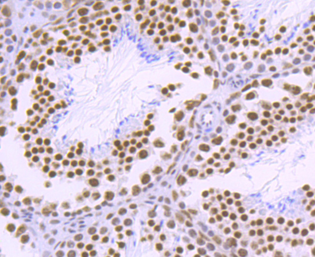 PABPN1 Antibody in Immunohistochemistry (Paraffin) (IHC (P))