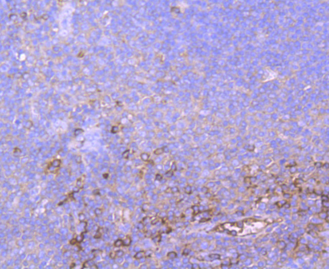 A2M Antibody in Immunohistochemistry (Paraffin) (IHC (P))