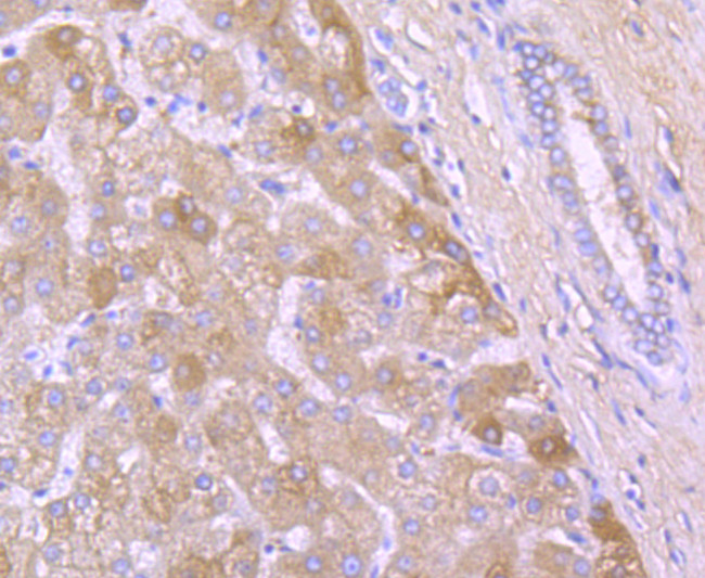 A2M Antibody in Immunohistochemistry (Paraffin) (IHC (P))