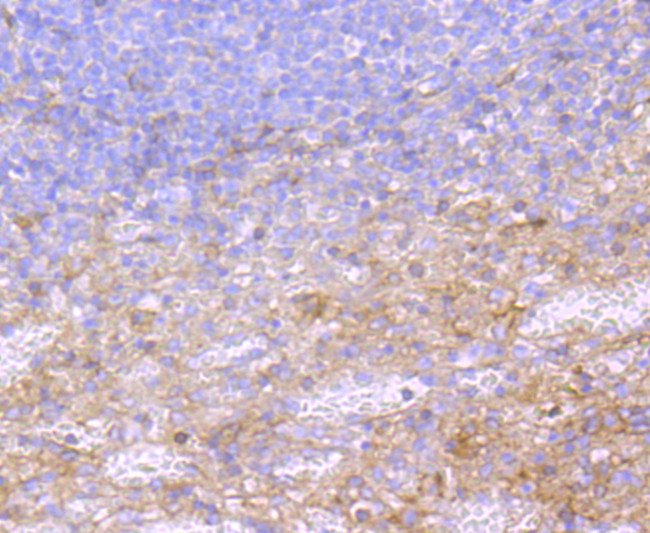 A2M Antibody in Immunohistochemistry (Paraffin) (IHC (P))