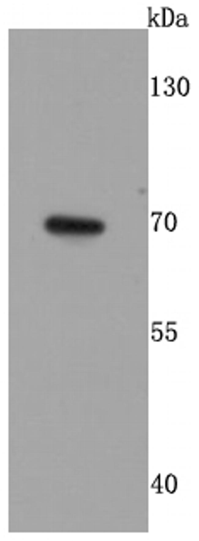 GAD67 Antibody in Western Blot (WB)