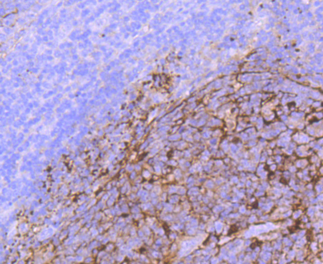 S100 Antibody in Immunohistochemistry (Paraffin) (IHC (P))