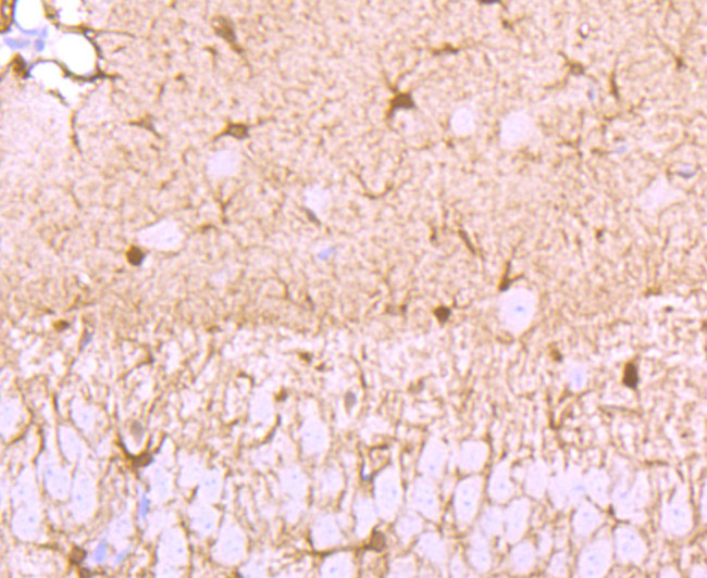 S100 Antibody in Immunohistochemistry (Paraffin) (IHC (P))