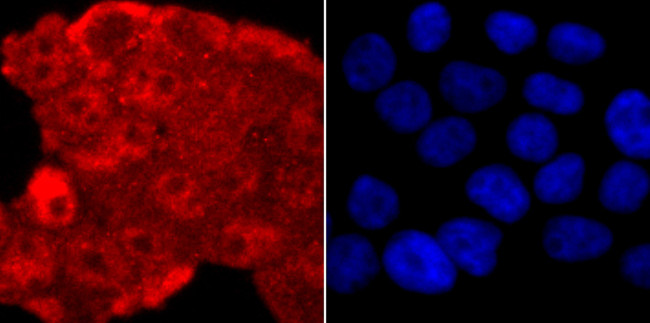 TDP-43 Antibody in Immunocytochemistry (ICC/IF)