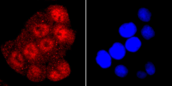 TDP-43 Antibody in Immunocytochemistry (ICC/IF)