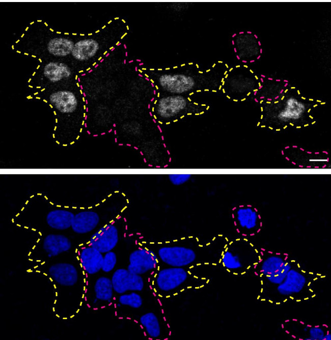 TDP-43 Antibody in Immunocytochemistry (ICC/IF)