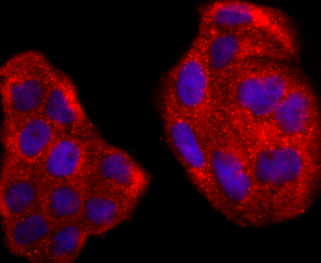 RAC1/RAC2/RAC3 Antibody in Immunocytochemistry (ICC/IF)