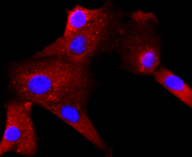 RAC1/RAC2/RAC3 Antibody in Immunocytochemistry (ICC/IF)