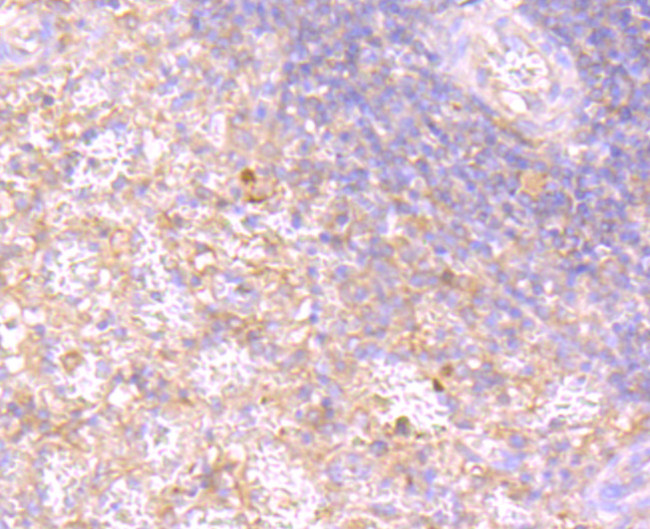 RAC1/RAC2/RAC3 Antibody in Immunohistochemistry (Paraffin) (IHC (P))