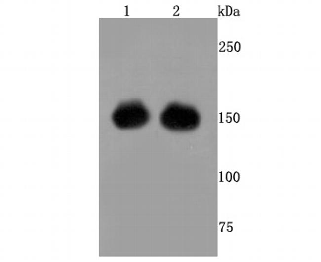 Cas9 Antibody in Western Blot (WB)