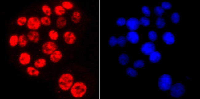 Phospho-RNA pol II CTD (Ser2) Antibody in Immunocytochemistry (ICC/IF)