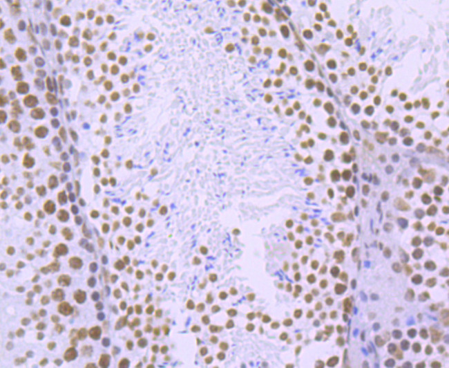 Phospho-RNA pol II CTD (Ser2) Antibody in Immunohistochemistry (Paraffin) (IHC (P))