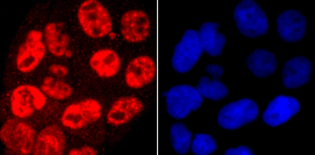 Phospho-RNA pol II CTD (Ser5) Antibody in Immunocytochemistry (ICC/IF)