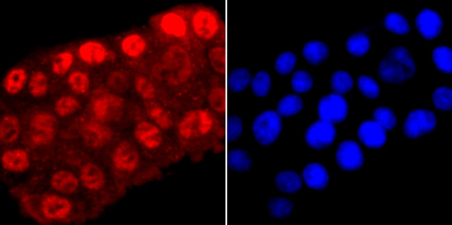 Phospho-RNA pol II CTD (Ser5) Antibody in Immunocytochemistry (ICC/IF)