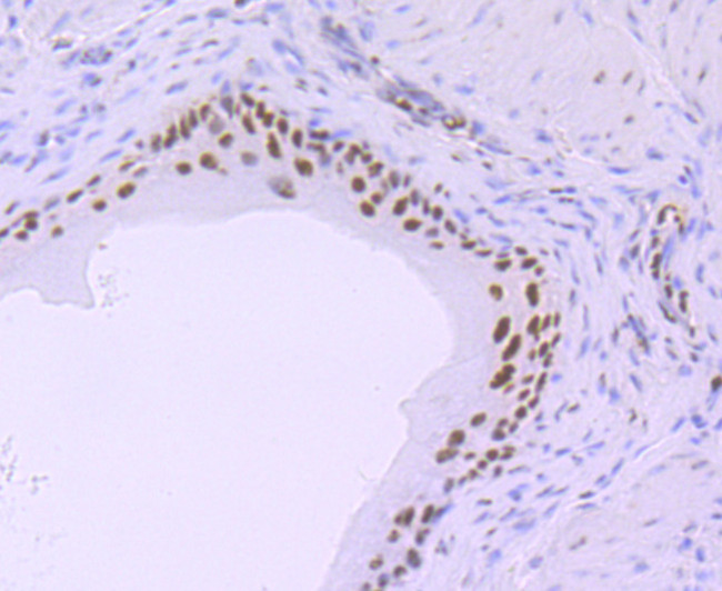 Phospho-RNA pol II CTD (Ser5) Antibody in Immunohistochemistry (Paraffin) (IHC (P))