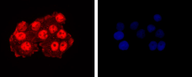 CTCF Antibody in Immunocytochemistry (ICC/IF)