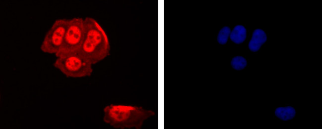 CTCF Antibody in Immunocytochemistry (ICC/IF)