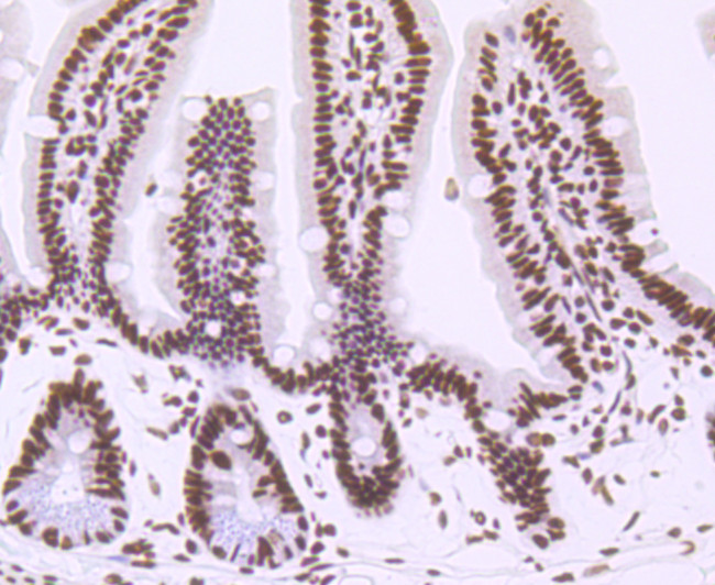 CTCF Antibody in Immunohistochemistry (Paraffin) (IHC (P))