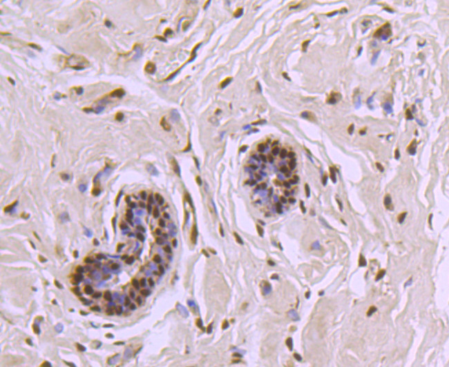 CTCF Antibody in Immunohistochemistry (Paraffin) (IHC (P))