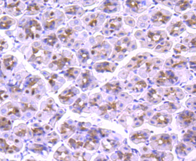 CTCF Antibody in Immunohistochemistry (Paraffin) (IHC (P))