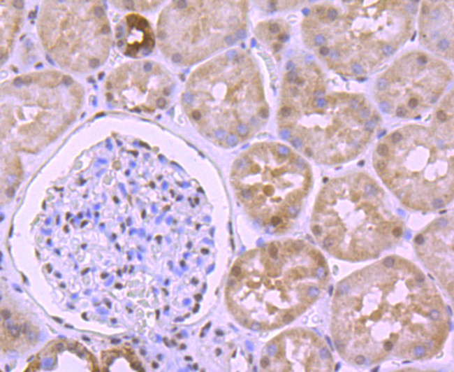 CTCF Antibody in Immunohistochemistry (Paraffin) (IHC (P))