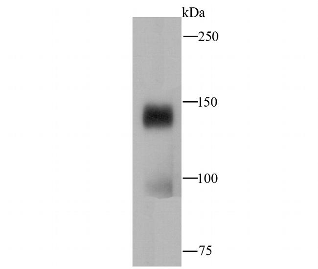 CTCF Antibody in Western Blot (WB)