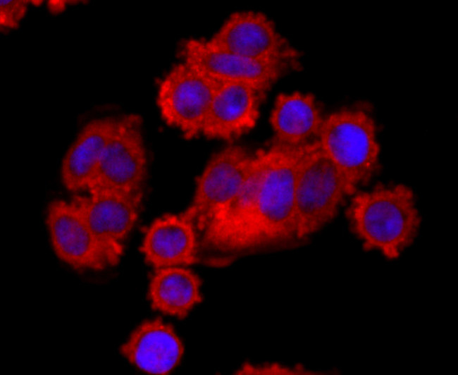 BID Antibody in Immunocytochemistry (ICC/IF)