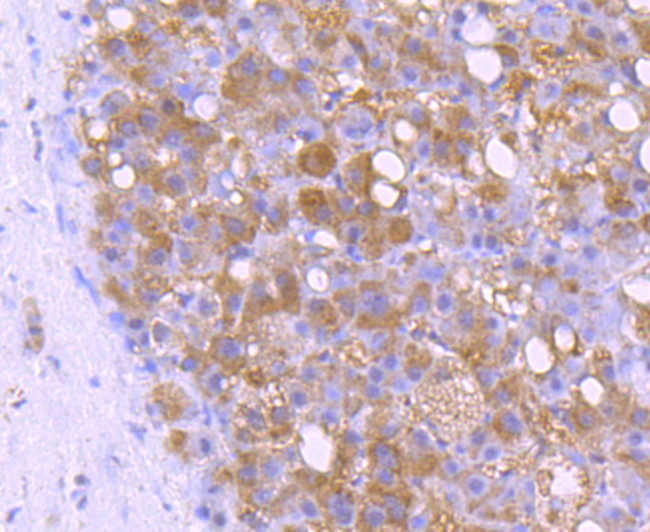 BID Antibody in Immunohistochemistry (Paraffin) (IHC (P))