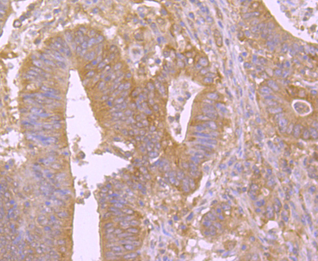 BID Antibody in Immunohistochemistry (Paraffin) (IHC (P))