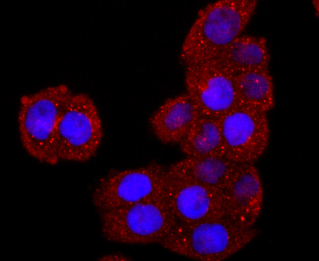 CD26 Antibody in Immunocytochemistry (ICC/IF)