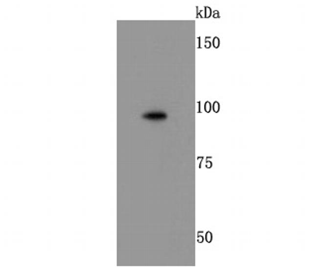CD18 (LFA-1 beta) Antibody in Western Blot (WB)