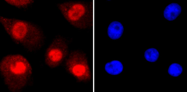 Ku70 Antibody in Immunocytochemistry (ICC/IF)