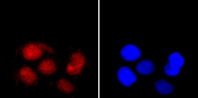 Ku70 Antibody in Immunocytochemistry (ICC/IF)