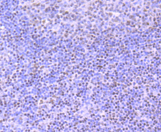 Ku70 Antibody in Immunohistochemistry (Paraffin) (IHC (P))