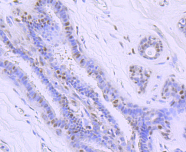 Ku70 Antibody in Immunohistochemistry (Paraffin) (IHC (P))