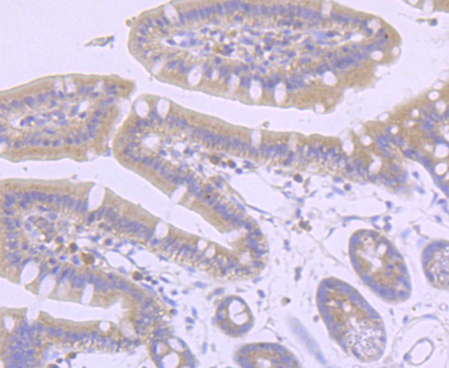 AXIN2 Antibody in Immunohistochemistry (Paraffin) (IHC (P))