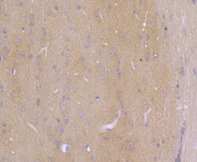 AXIN2 Antibody in Immunohistochemistry (Paraffin) (IHC (P))