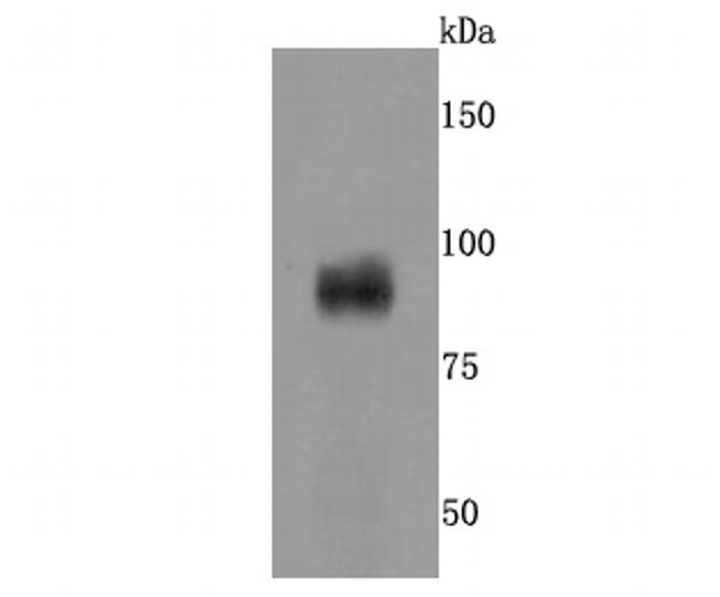 AXIN2 Antibody in Western Blot (WB)